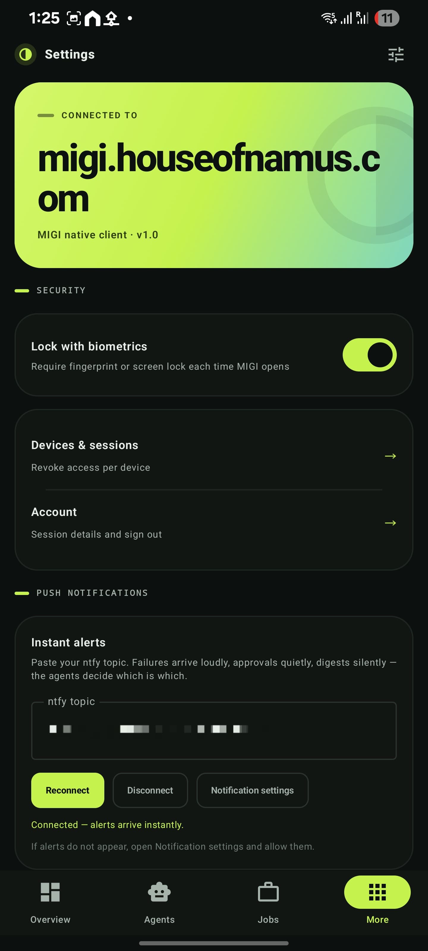 MIGI settings